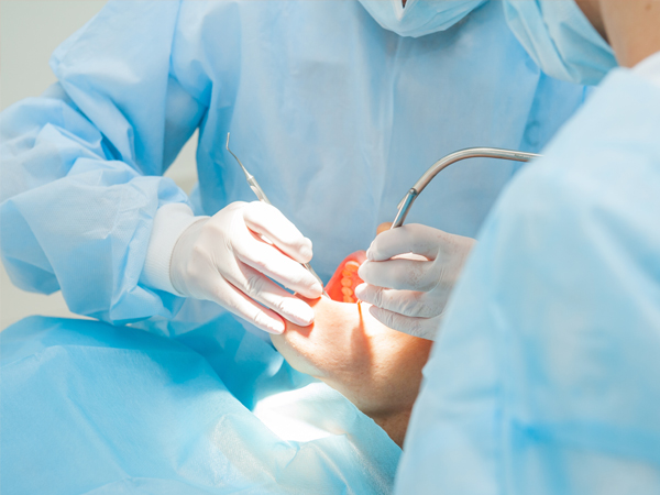 歯周病に対する再生療法