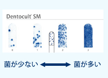 虫歯菌の数の検査